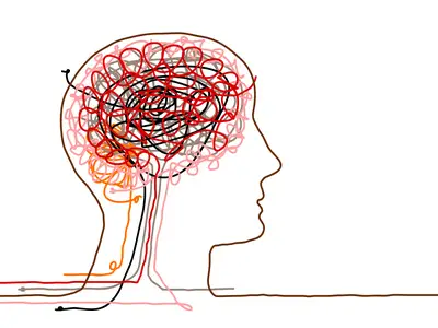 Trimma om synapserna
